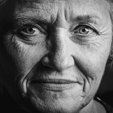 皮肤与身体的衰老痕迹
